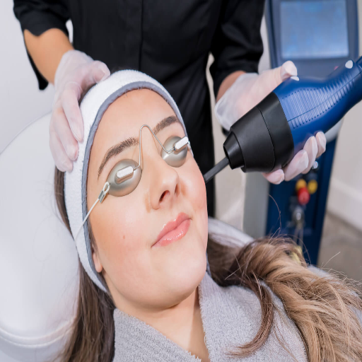 How to Prepare for CO2 Laser Resurfacing?